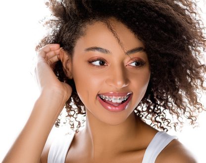 Understanding the Orthodontic Process: What to Expect When Getting Braces in Burnaby