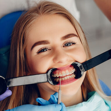 Why Orthodontics for Teens Benefits of Early Intervention