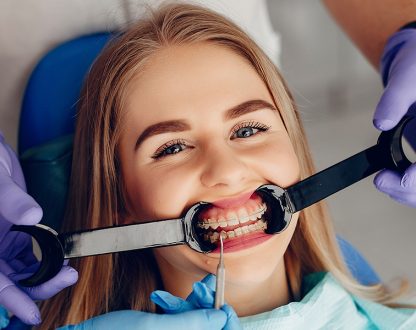 Why Orthodontics for Teens Benefits of Early Intervention
